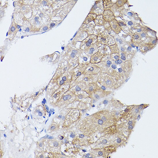 GNA11 Antibody