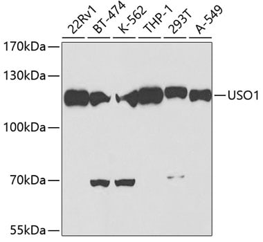 VDP p115 Antibody