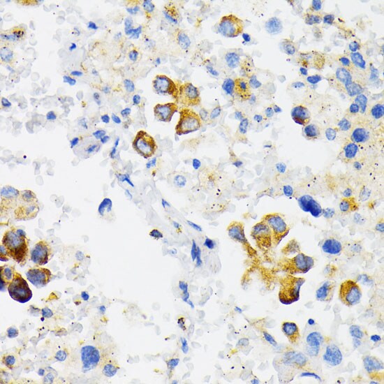 VDP p115 Antibody