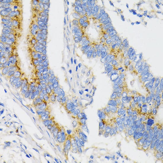 VDP p115 Antibody