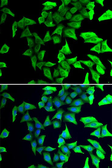 visinin-like 1 Antibody