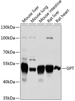GPT Antibody