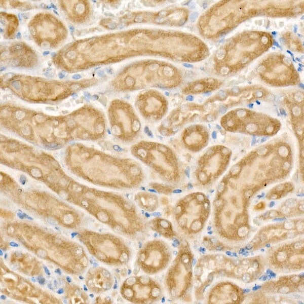 CPT2 Antibody
