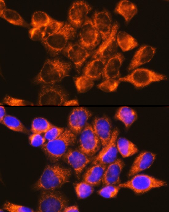 DAP5 Antibody