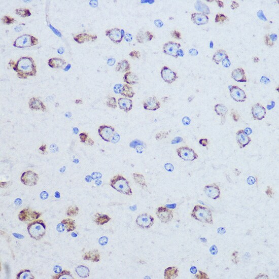 DAP5 Antibody