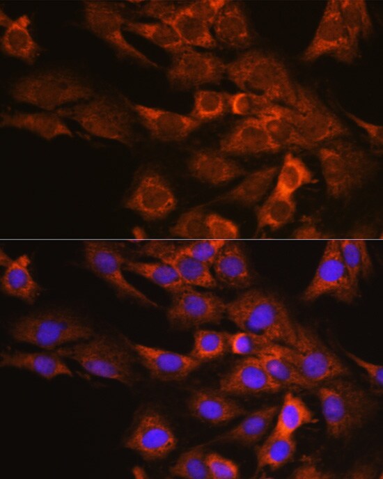DAP5 Antibody