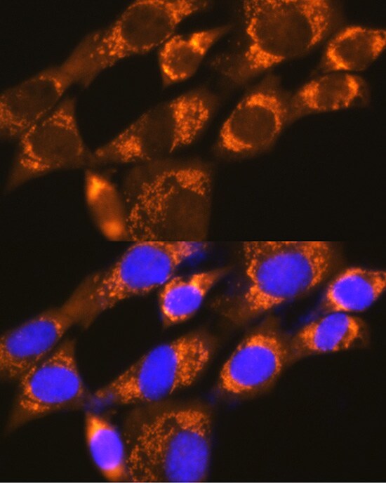 DAP5 Antibody