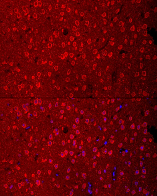 EAAT3 Antibody