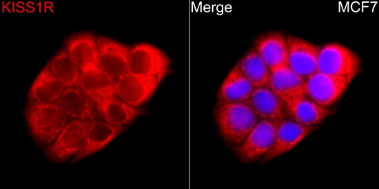 KiSS1R/GPR54 Antibody