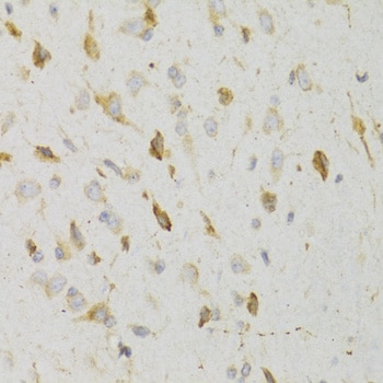 KiSS1R/GPR54 Antibody