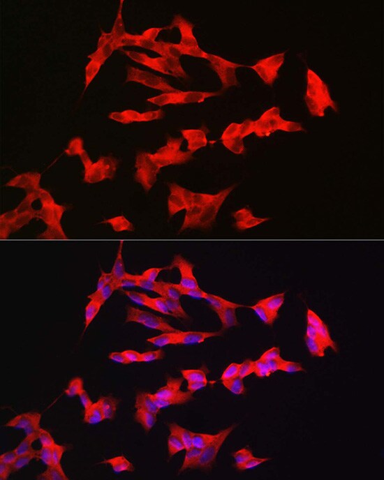 PAC1R Antibody