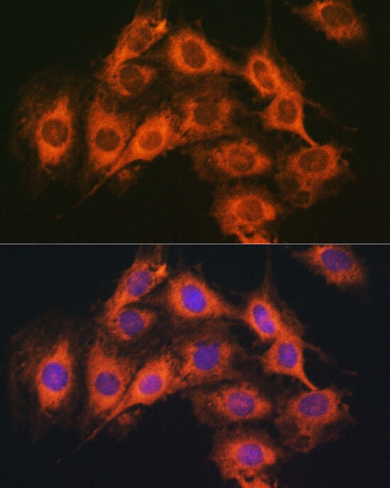 PAC1R Antibody