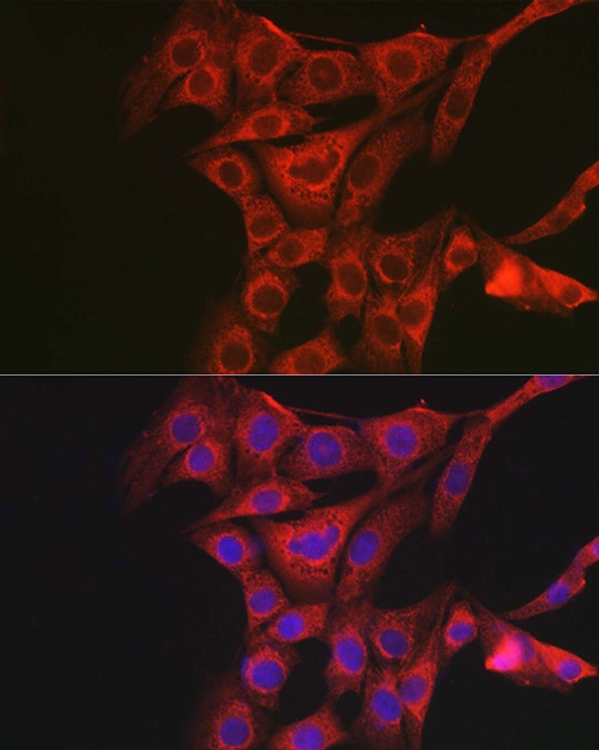 PAC1R Antibody