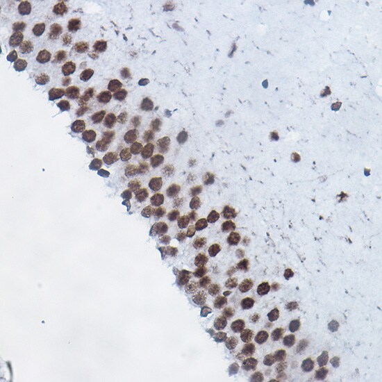 H4 Clustered Histone 1 [Monomethyl Arg3] Antibody