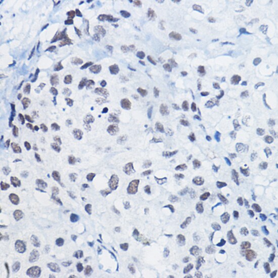 H4 Clustered Histone 1 [Monomethyl Arg3] Antibody