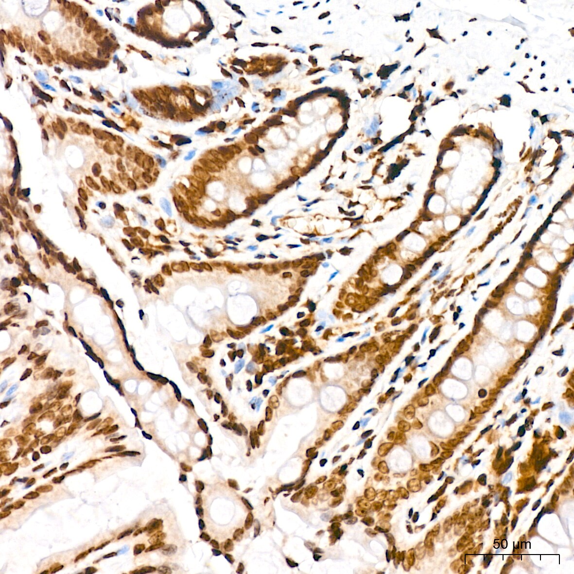 H4 Clustered Histone 1 [Sym-dimethyl Arg3] Antibody