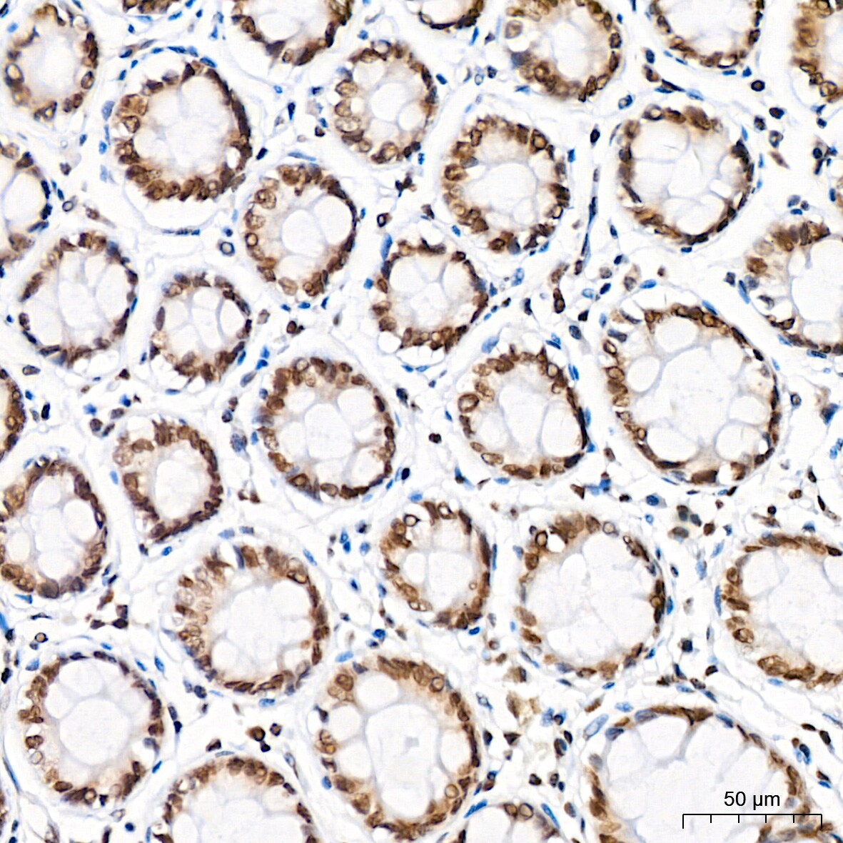 H4 Clustered Histone 1 [Sym-dimethyl Arg3] Antibody