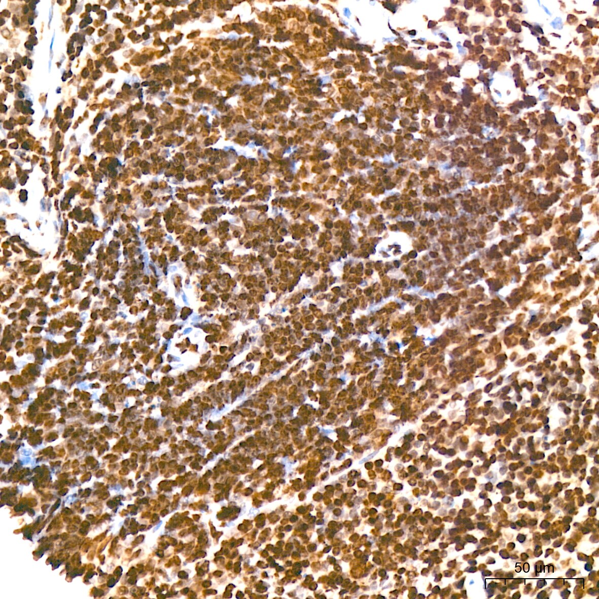 H4 Clustered Histone 1 [Sym-dimethyl Arg3] Antibody