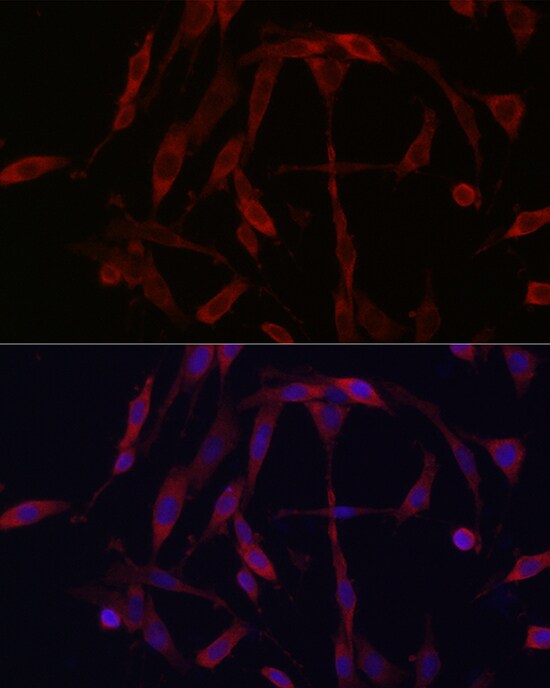 Kinesin 5A Antibody