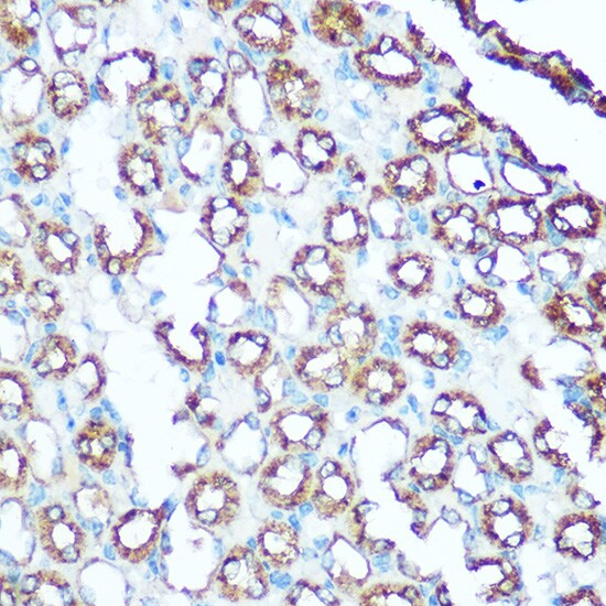 UQCRC1 Antibody