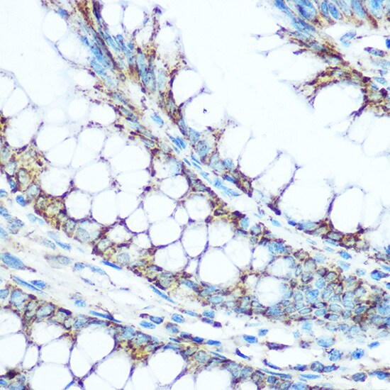 UQCRC1 Antibody