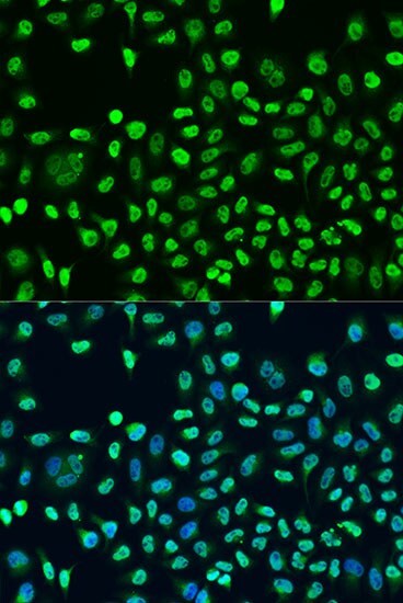 STAU2 Antibody