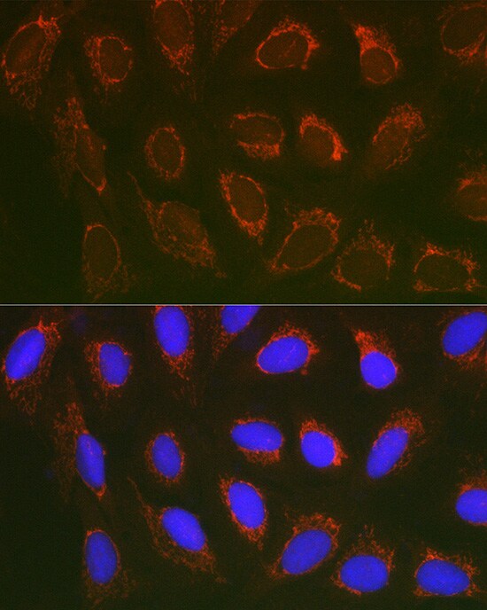 SLC25A6 Antibody
