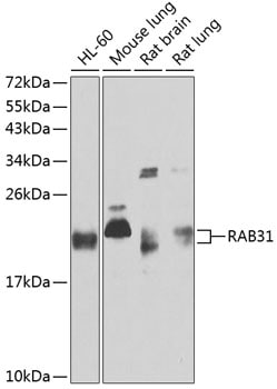 RAB31 Antibody