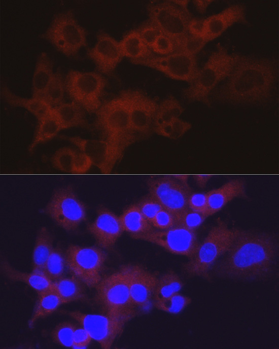 Aldolase B Antibody
