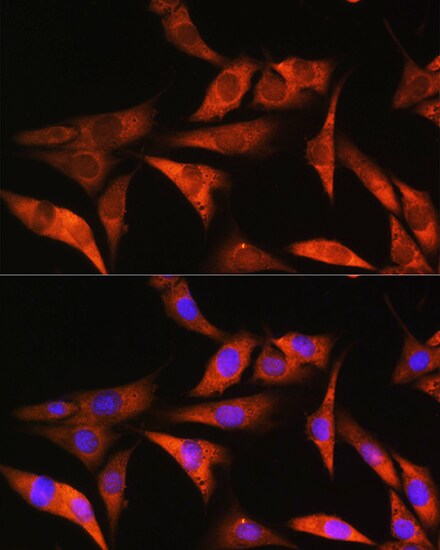 Aldolase B Antibody