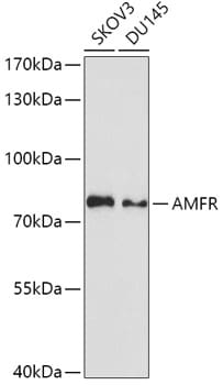AMFR/gp78 Antibody