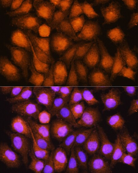 ASNA1 Antibody