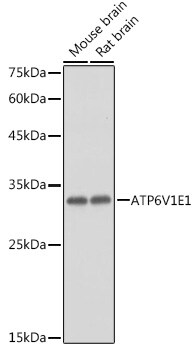 ATP6V1E1 Antibody