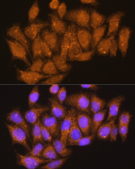 ATP6V1E1 Antibody