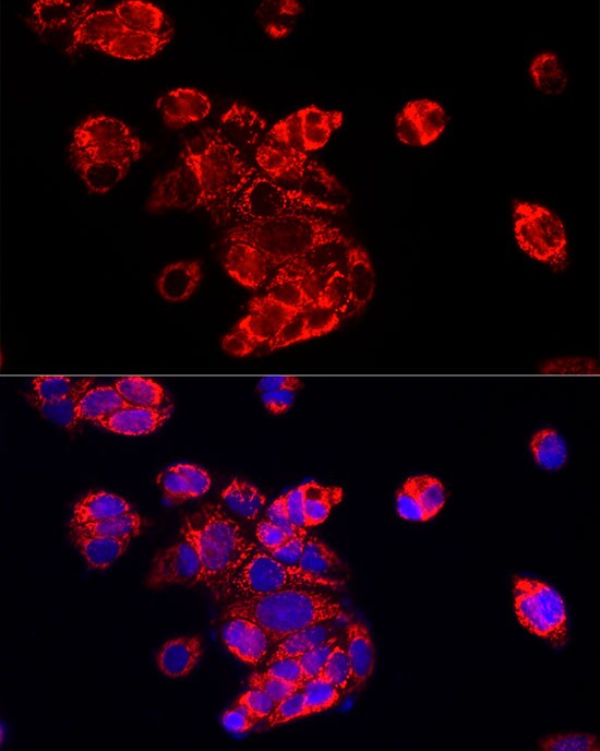 ECHS1 Antibody
