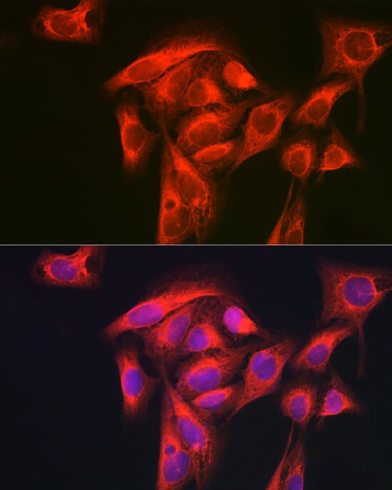 GART Antibody