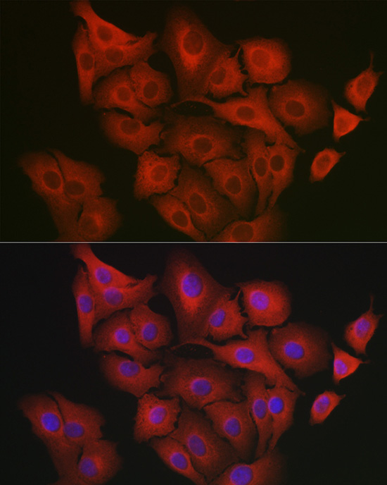 GART Antibody