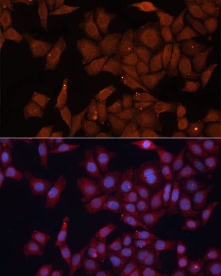 HMGCS1 Antibody