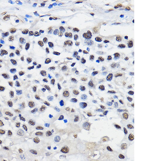 hnRNP U Antibody