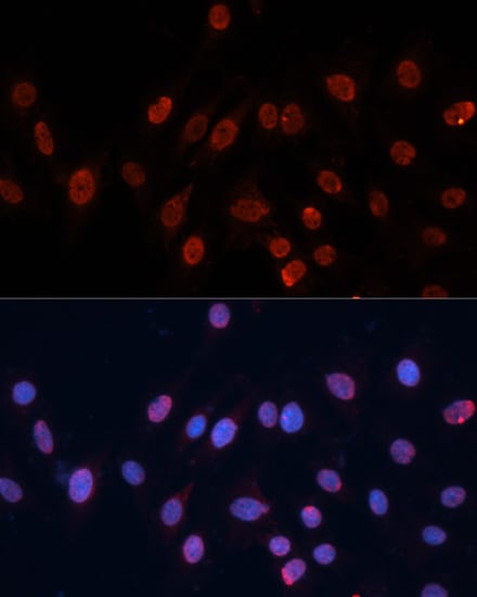 hnRNP U Antibody