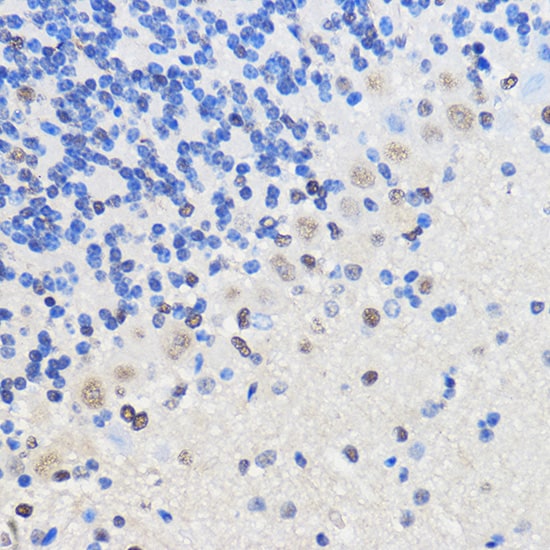 hnRNP U Antibody