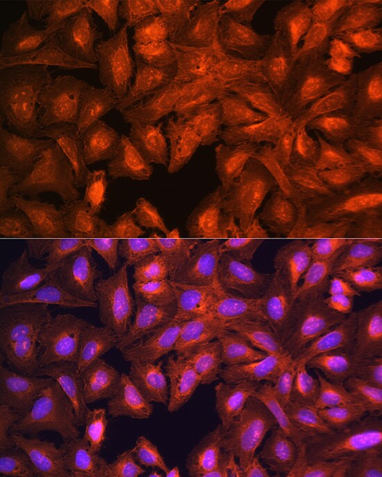 LASP1 Antibody