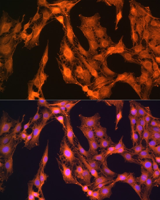 LASP1 Antibody