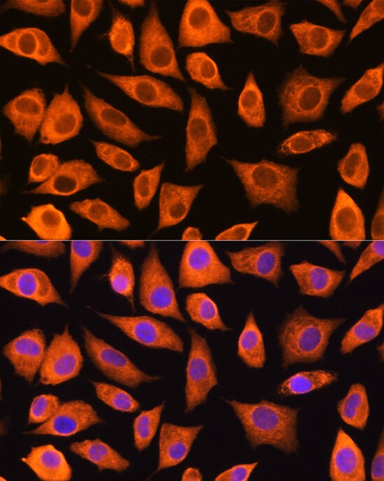 LASP1 Antibody