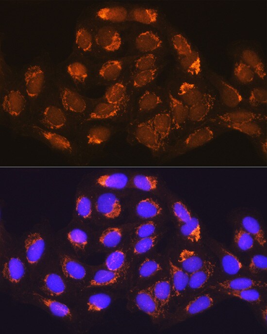 Methylmalonyl Coenzyme A mutase Antibody