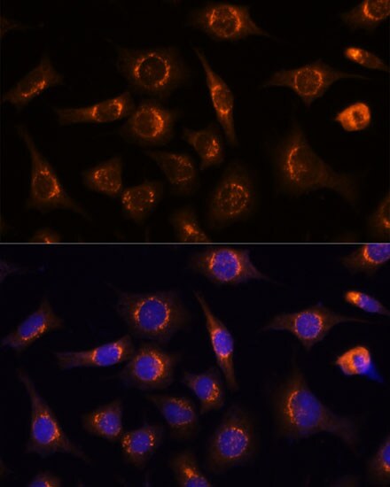 Nucleobindin 1 Antibody