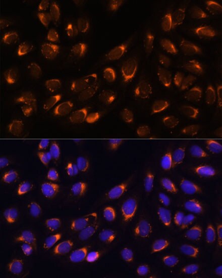 Nucleobindin 1 Antibody
