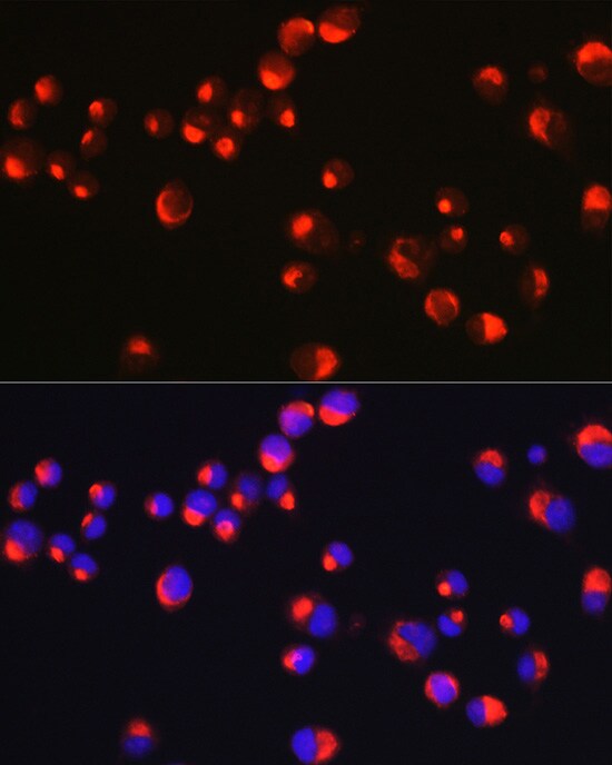 Peripherin Antibody