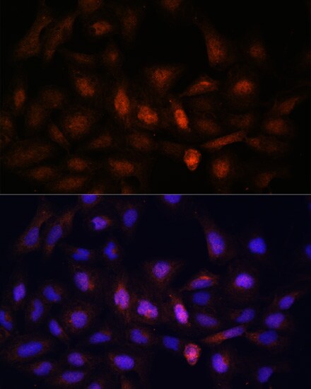 PSMA7 Antibody
