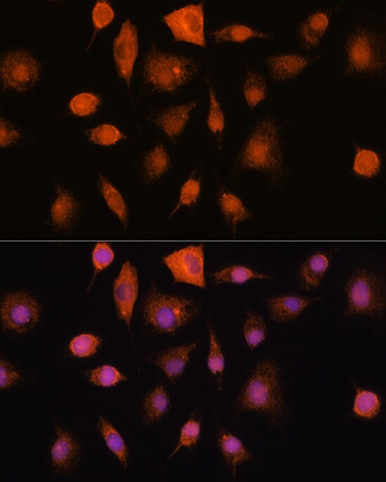 Ribonuclease Inhibitor Antibody